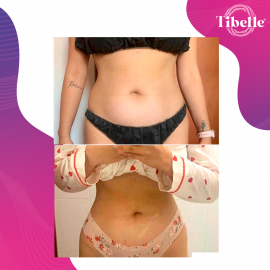Testimonio_enzimas_tibelle_1